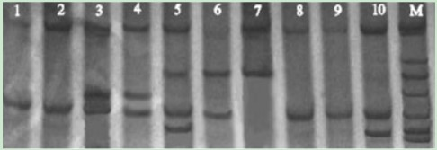 DNA silver staining method in polyacrylamide gel electrophoresis