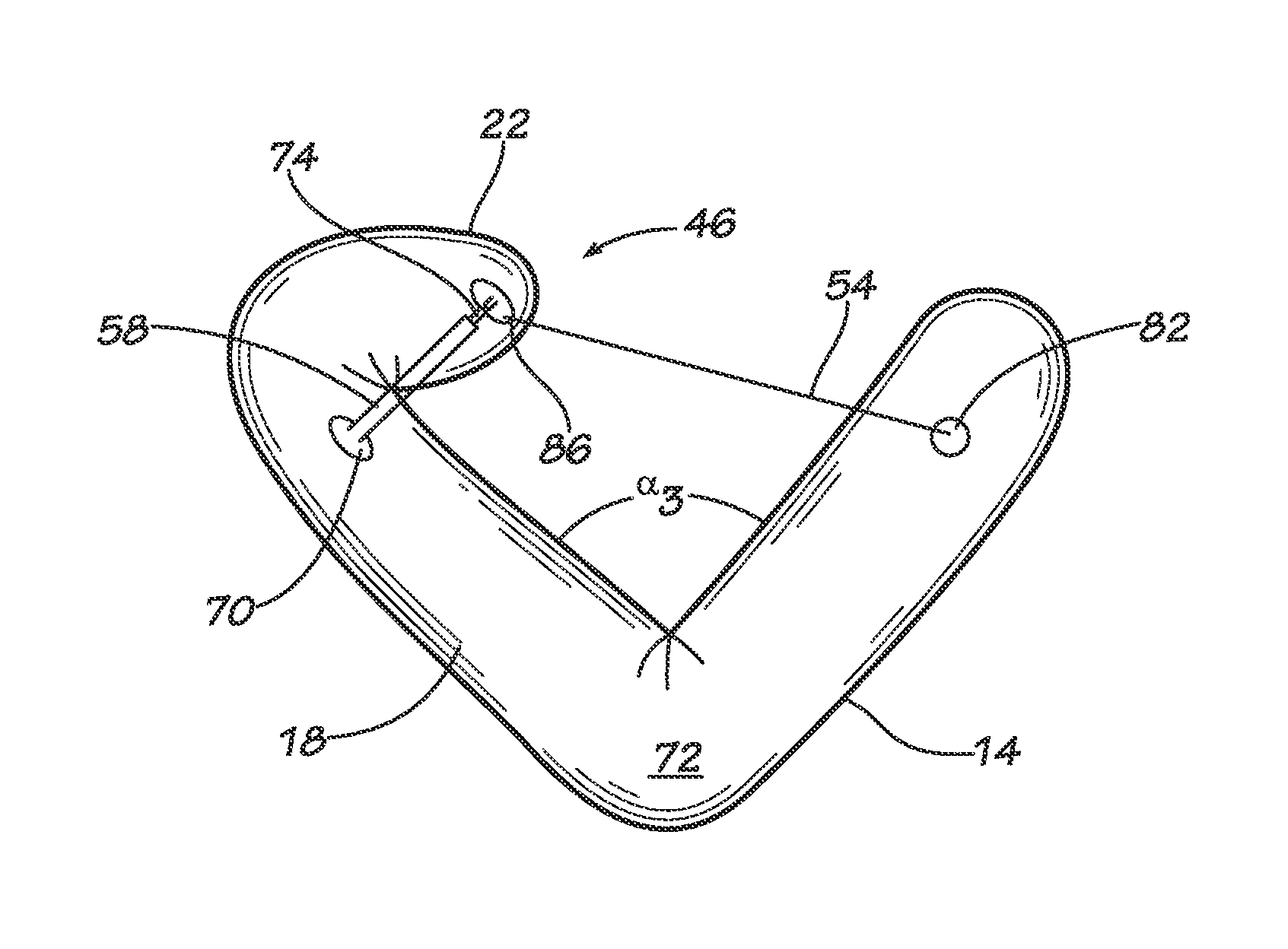 Restraints principally for inflatable evacuation systems