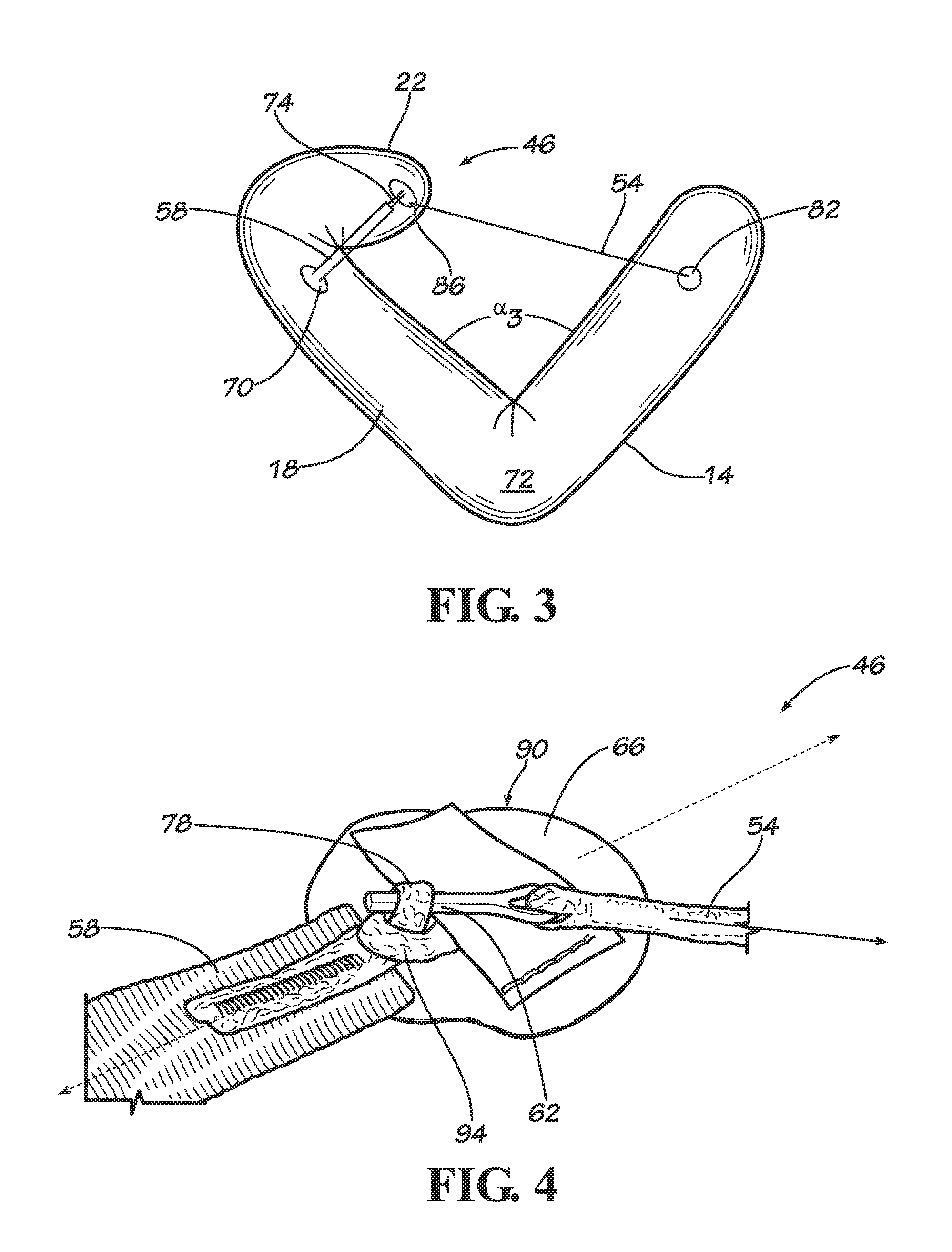 Restraints principally for inflatable evacuation systems