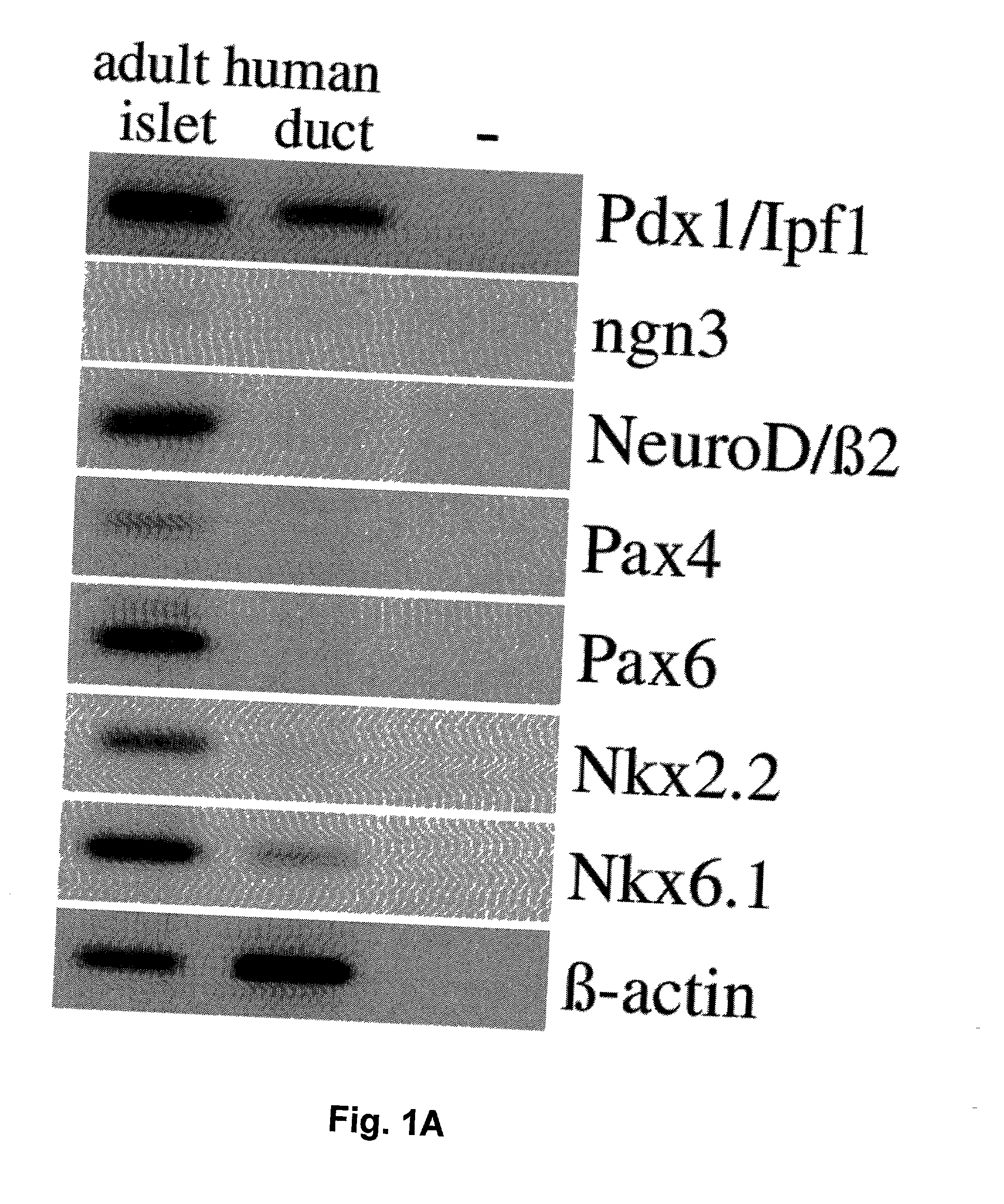 Methods for generating insulin-secreting cells suitable for transplantation