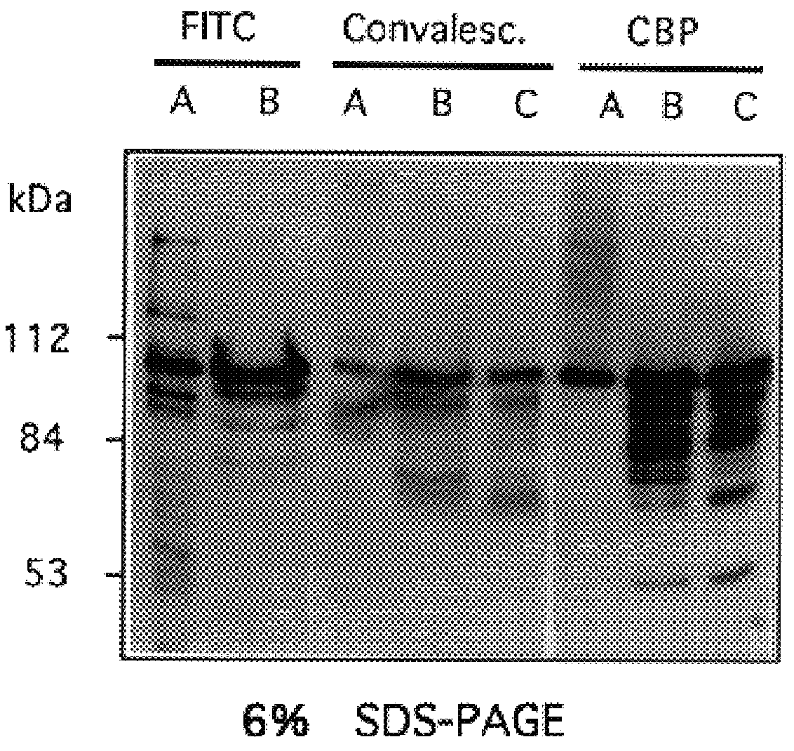 Choline binding proteins for anti-pneumococcal vaccines