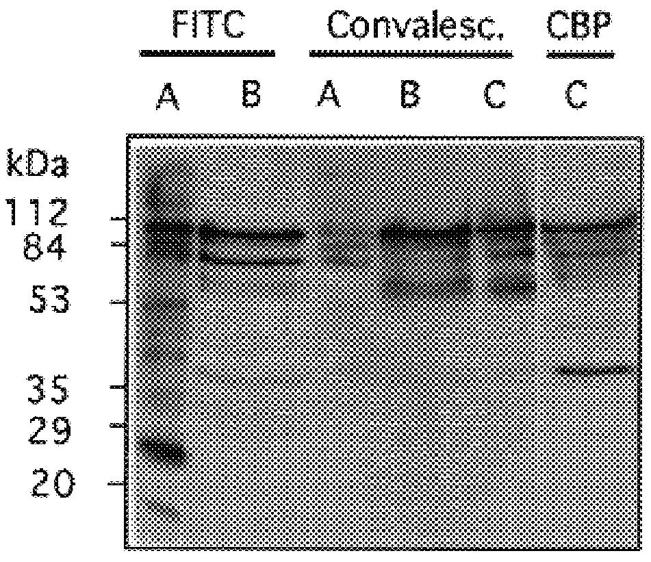 Choline binding proteins for anti-pneumococcal vaccines