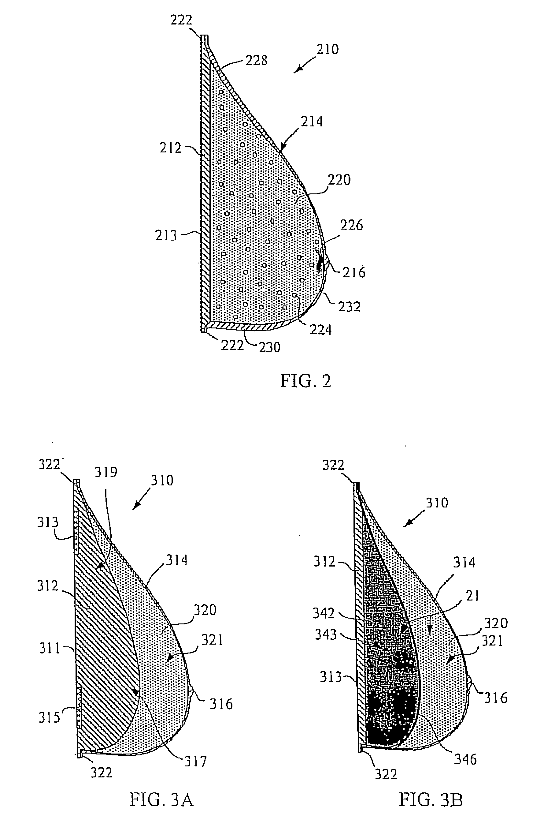 External breast prosthesis