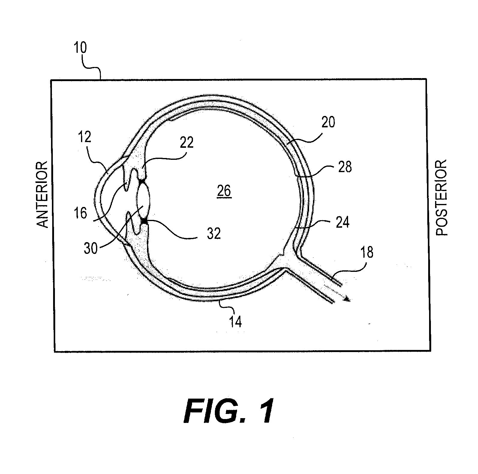 Modular intraocular lens designs and methods