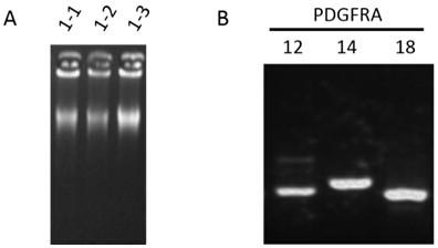 Primer combination and its application for detecting pdgfra gene mutation in trace tissue