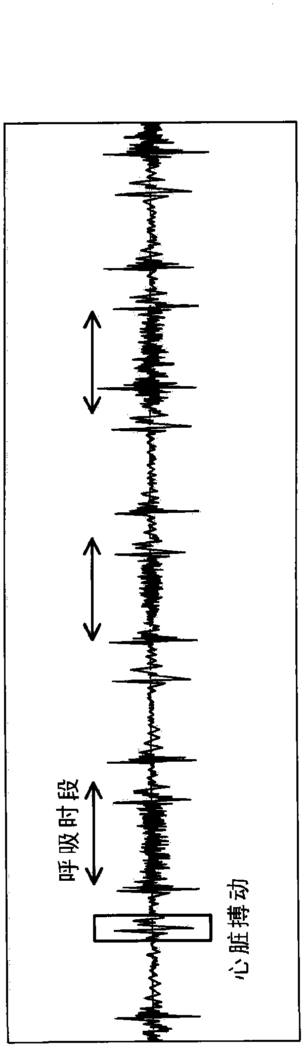 Respiratory signal processing apparatus, respiratory signal processing method, and program