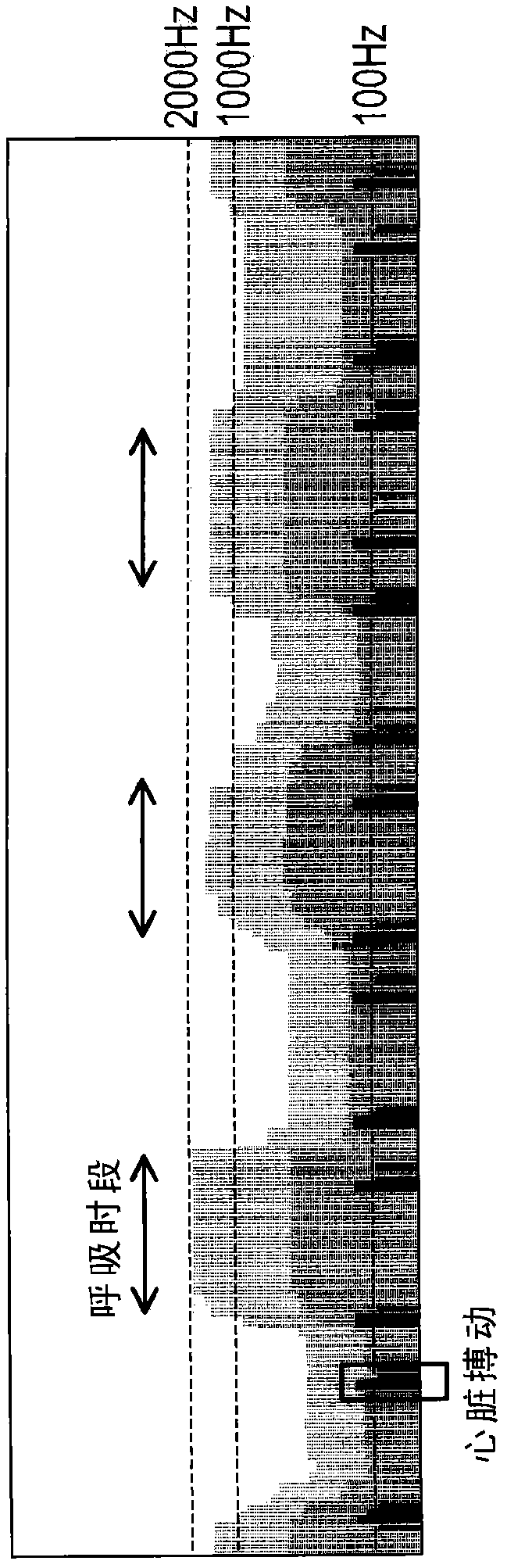 Respiratory signal processing apparatus, respiratory signal processing method, and program