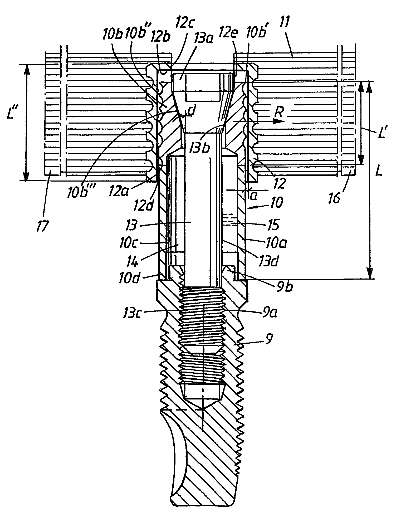 Implant arrangement and device