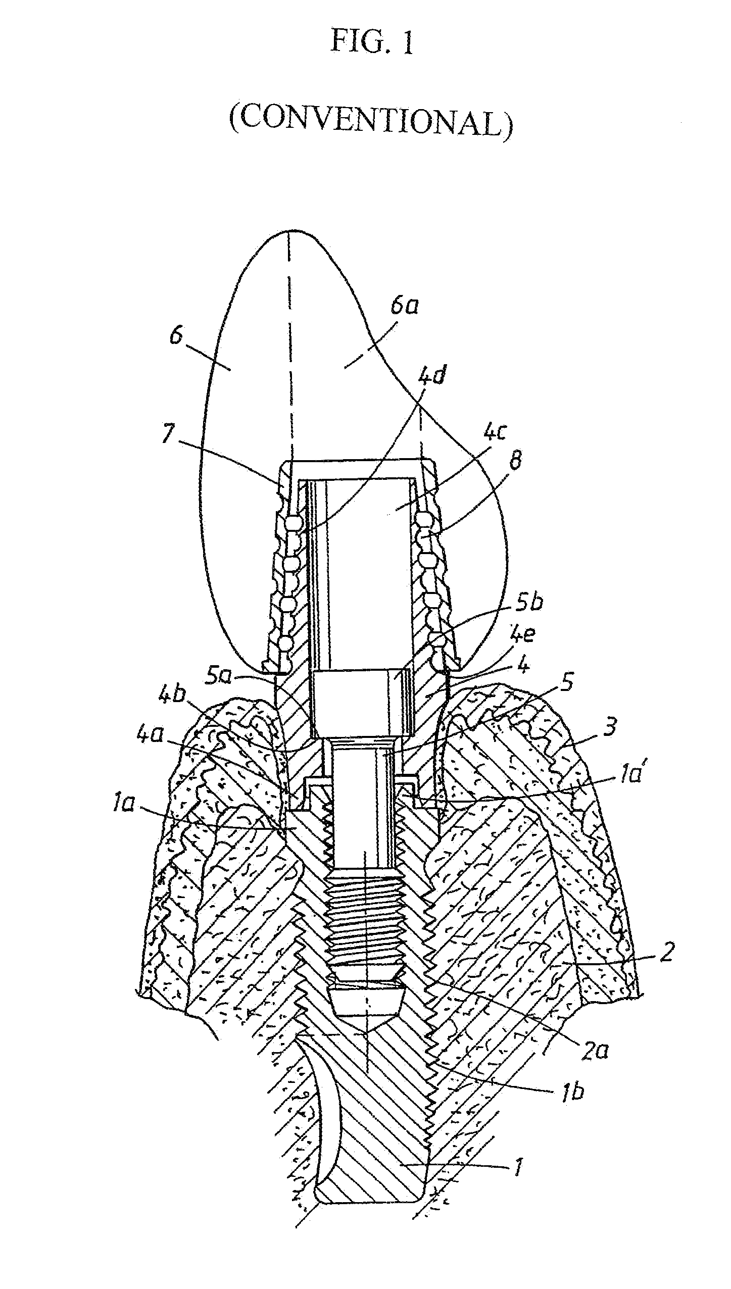 Implant arrangement and device