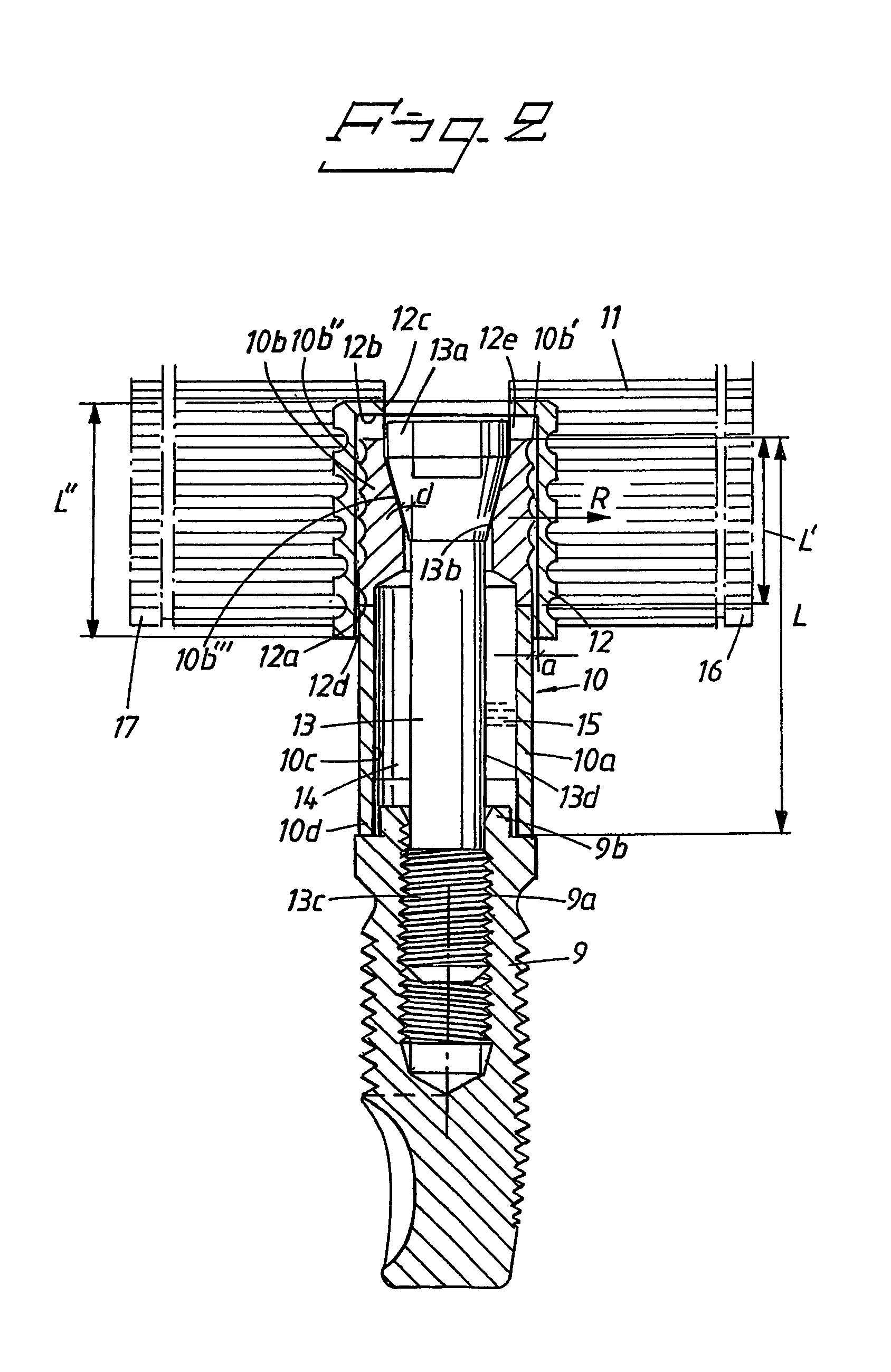 Implant arrangement and device