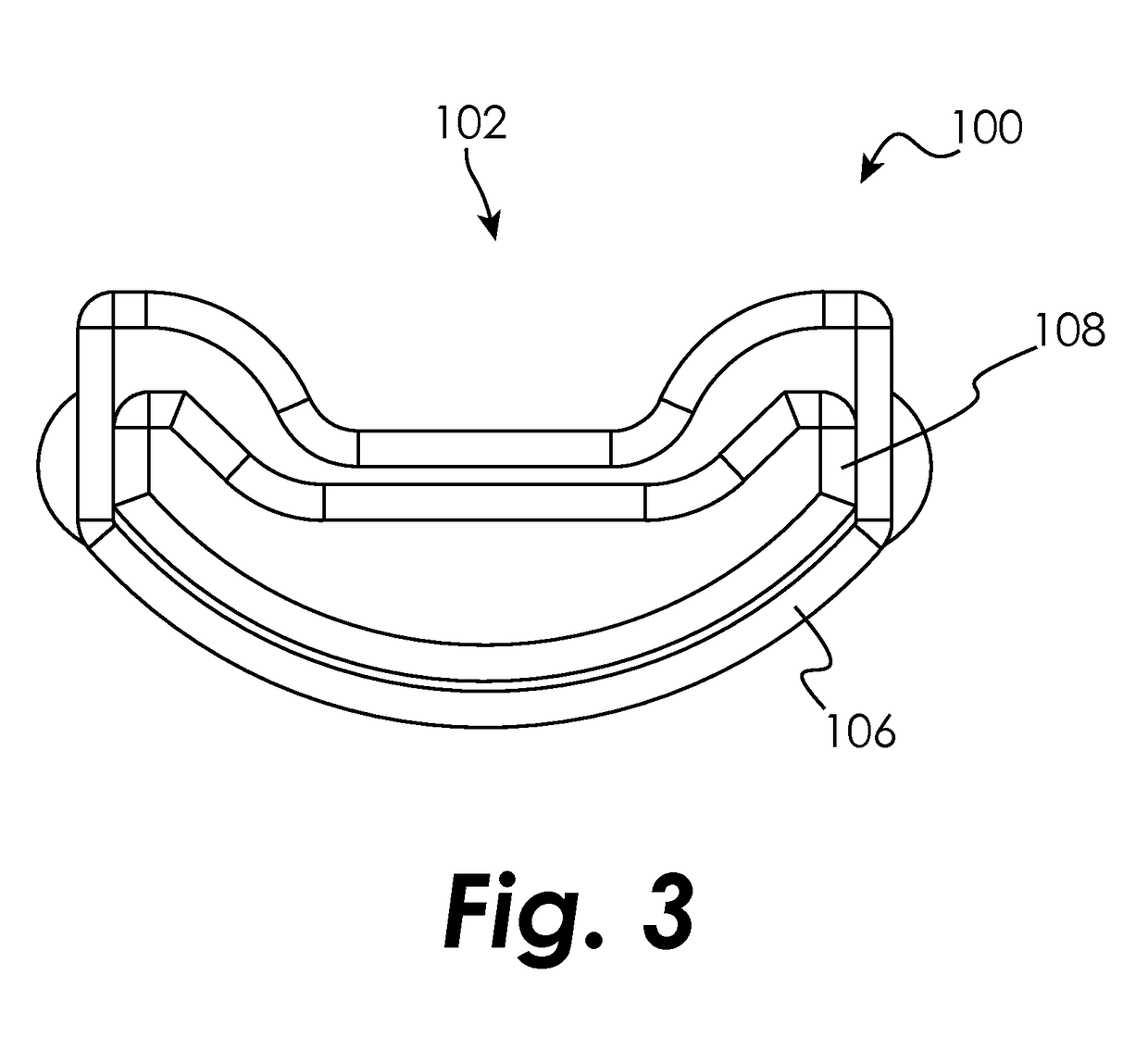 Plasma resection electrode