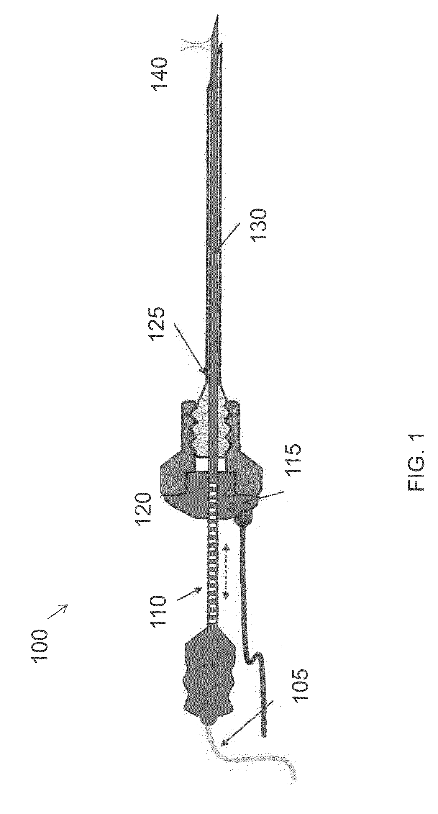 Apparatus and Method for Assessment of Interstitial Tissue