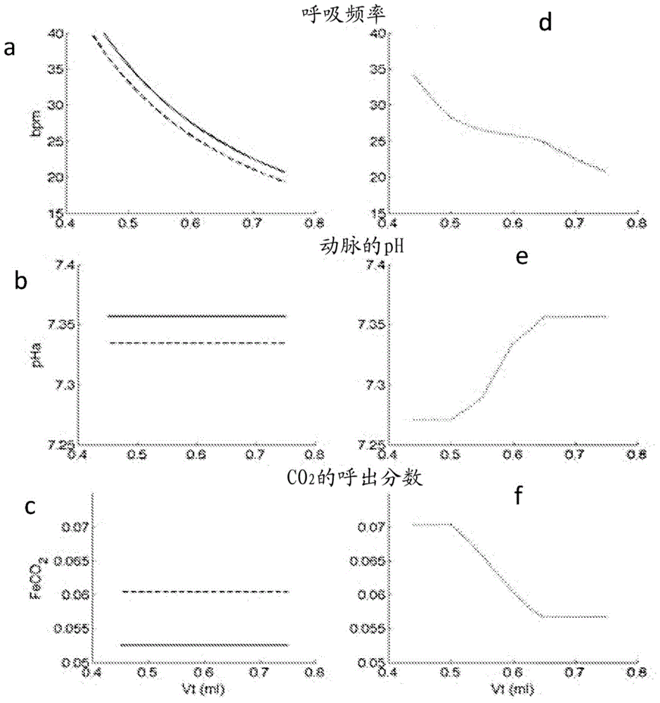 A system and a corresponding method for estimating respiratory drive of mechanically ventilated patients