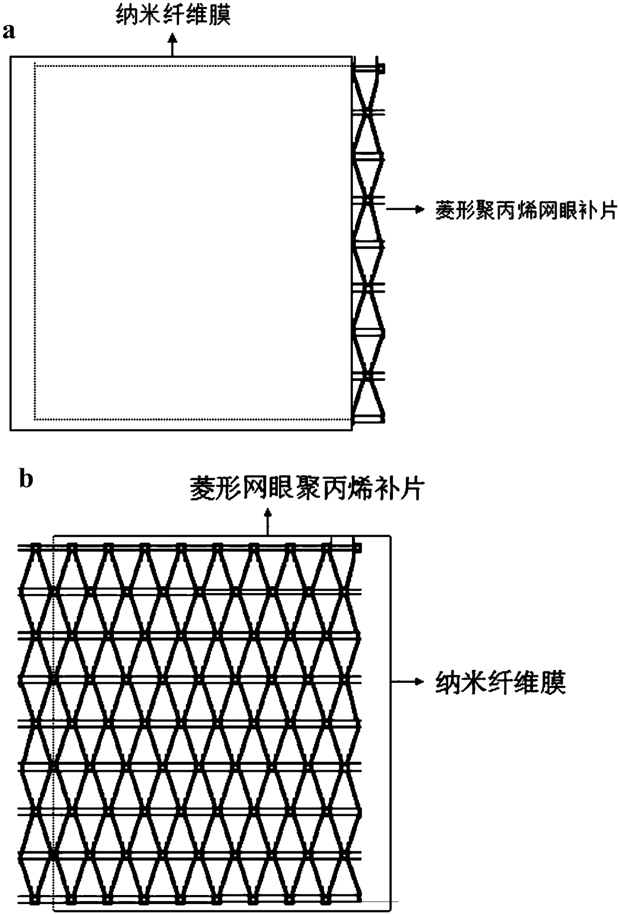 An electrospun film-coated composite pelvic floor patch and preparation method thereof