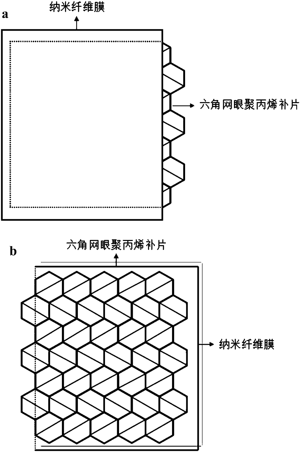 An electrospun film-coated composite pelvic floor patch and preparation method thereof