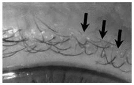 Eyelash care composition with anti-falling and anti-breaking functions