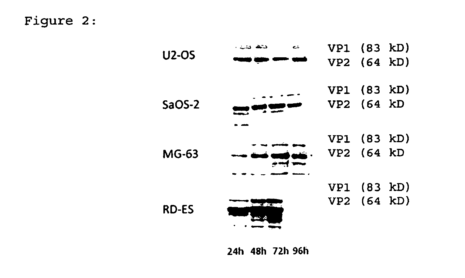 Oncolytic virotherapy for the therapy of sarcoma