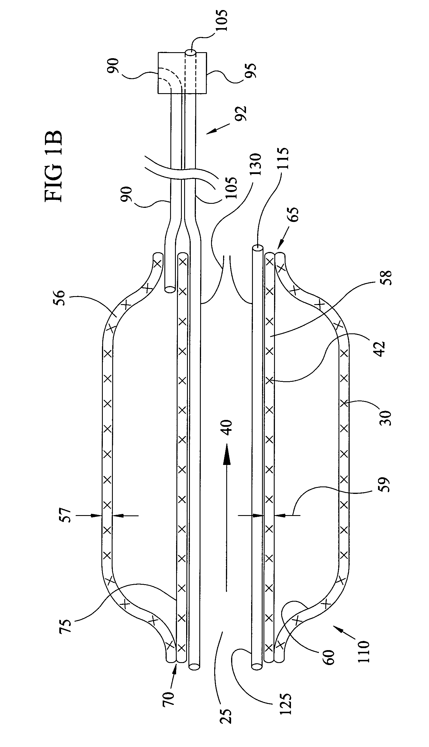 Expandable perfusion balloon