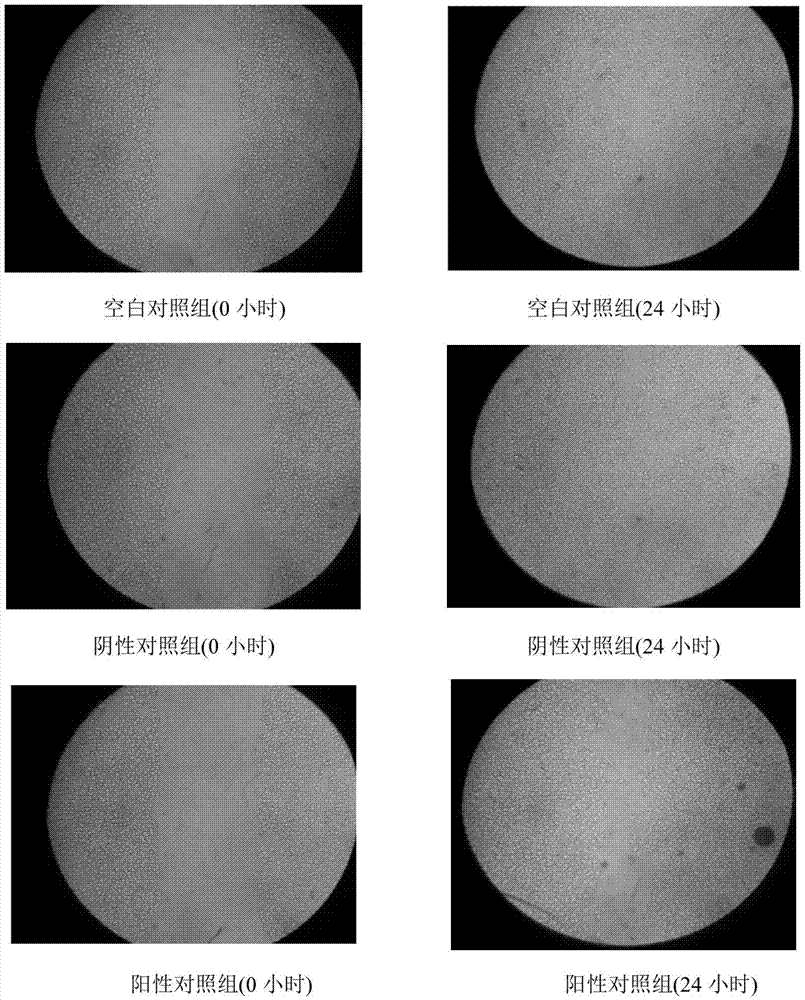 Application of orientin in the preparation of drugs for inhibiting angiogenesis