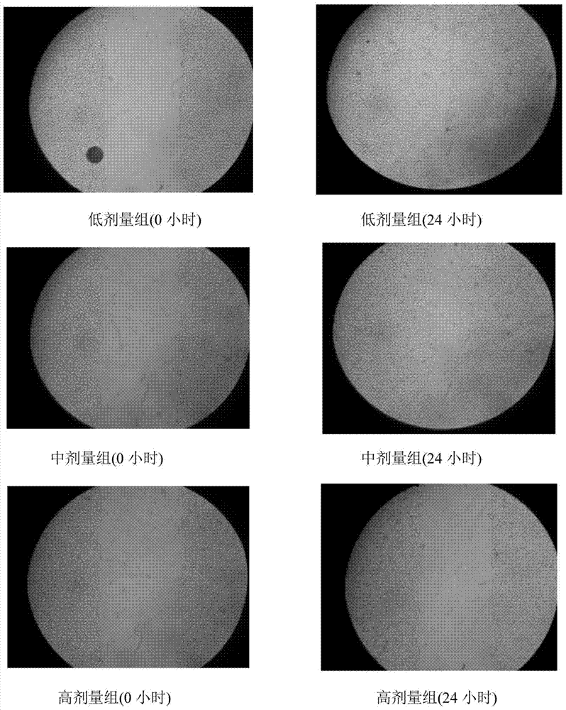 Application of orientin in the preparation of drugs for inhibiting angiogenesis