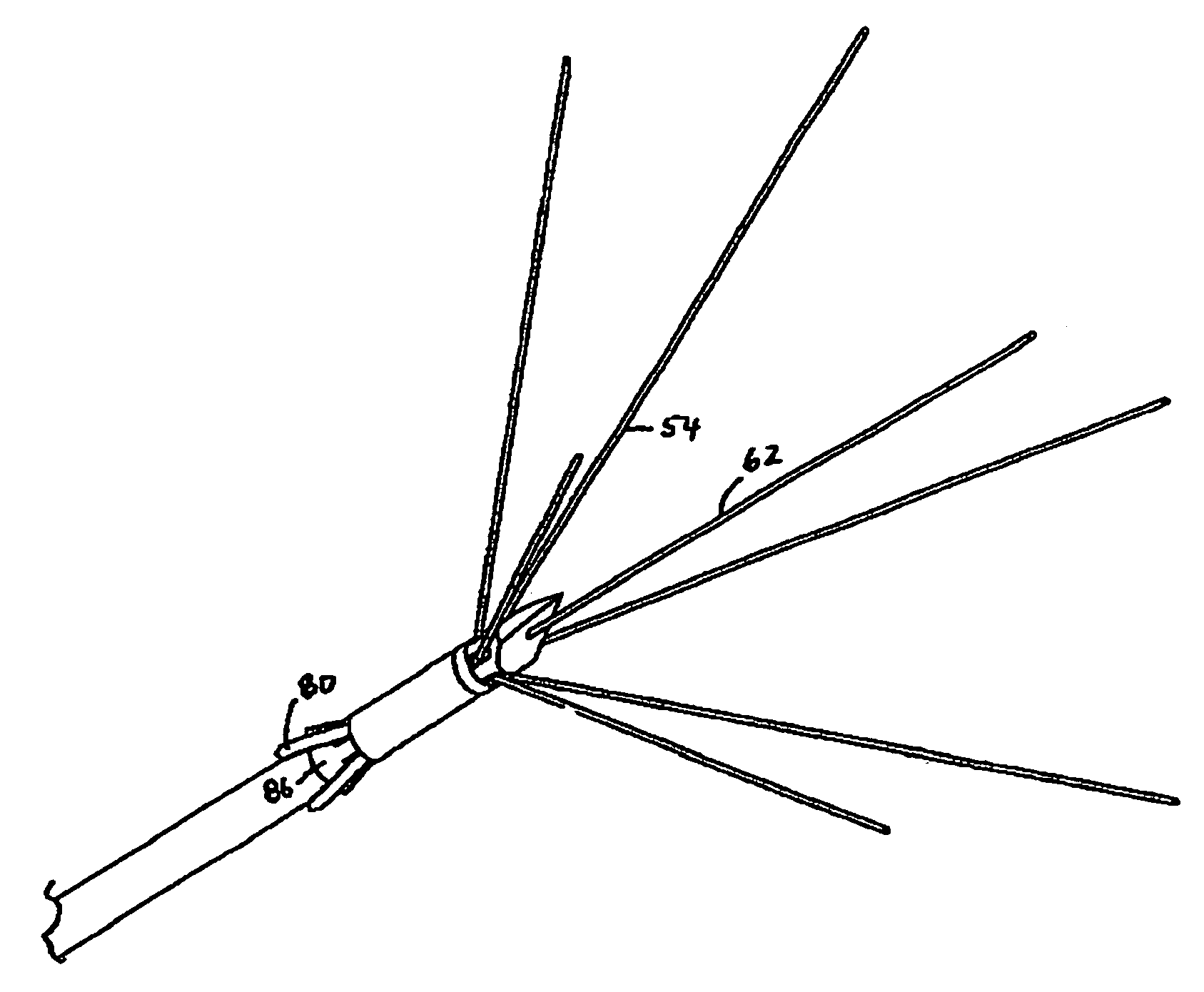 Anchored RF ablation device for the destruction of tissue masses