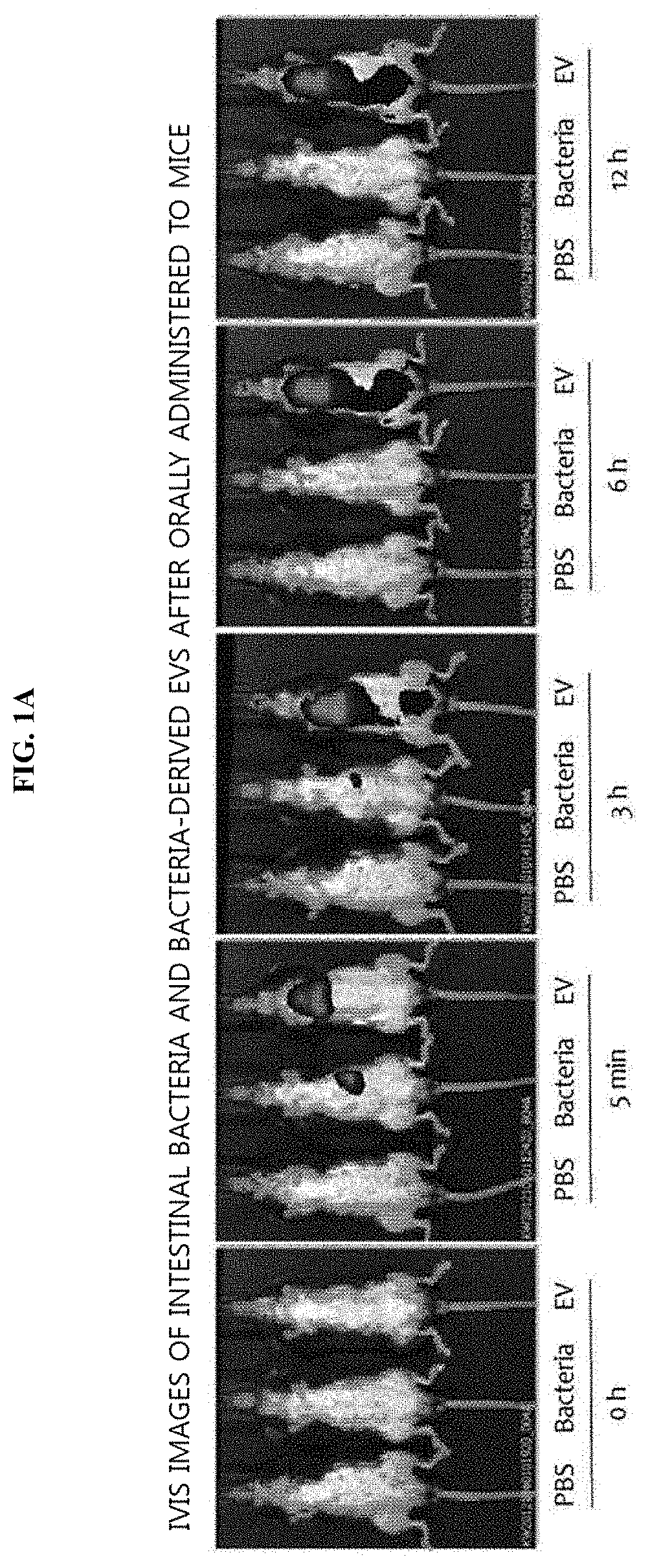 Method for diagnosing head and neck cancer via bacterial metagenomic analysis