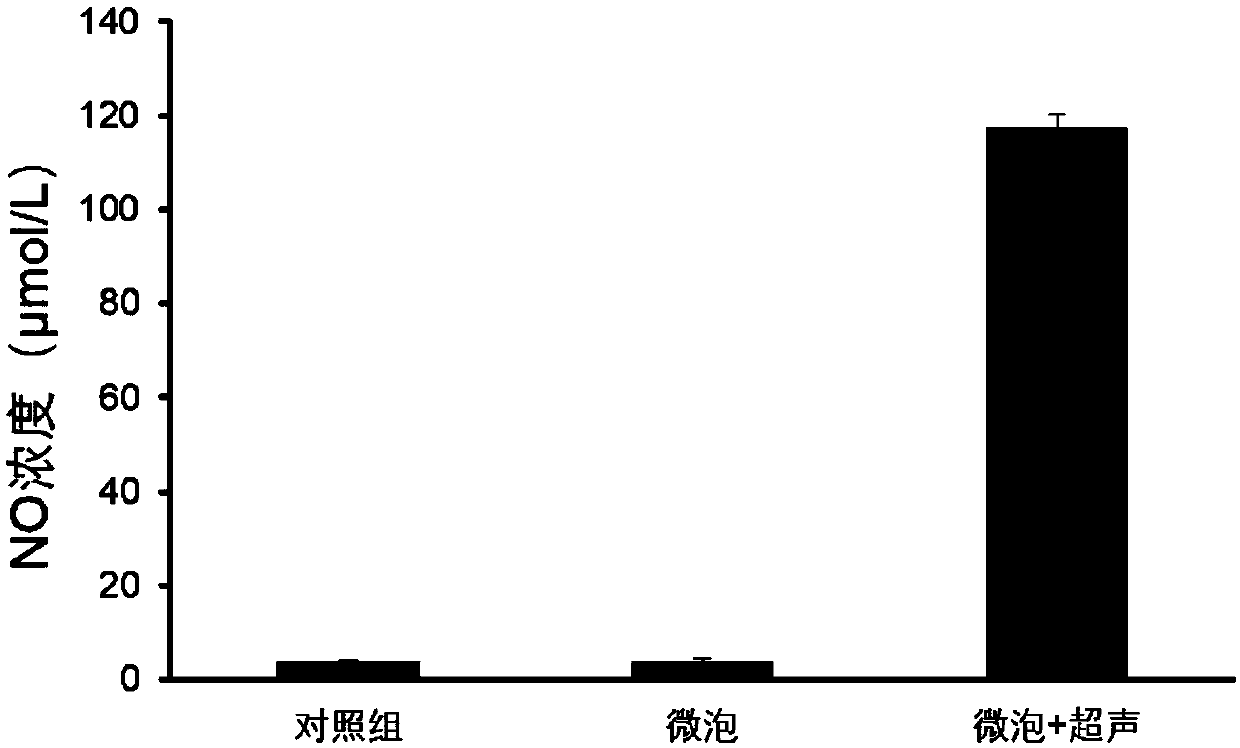 Ultrasonic contrast agent and preparation method thereof