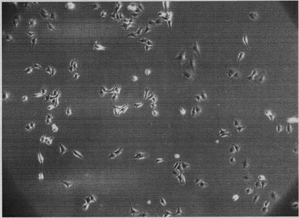 A method for preparing tissue-engineered spinal cord using dermal-derived mesenchymal stem cells