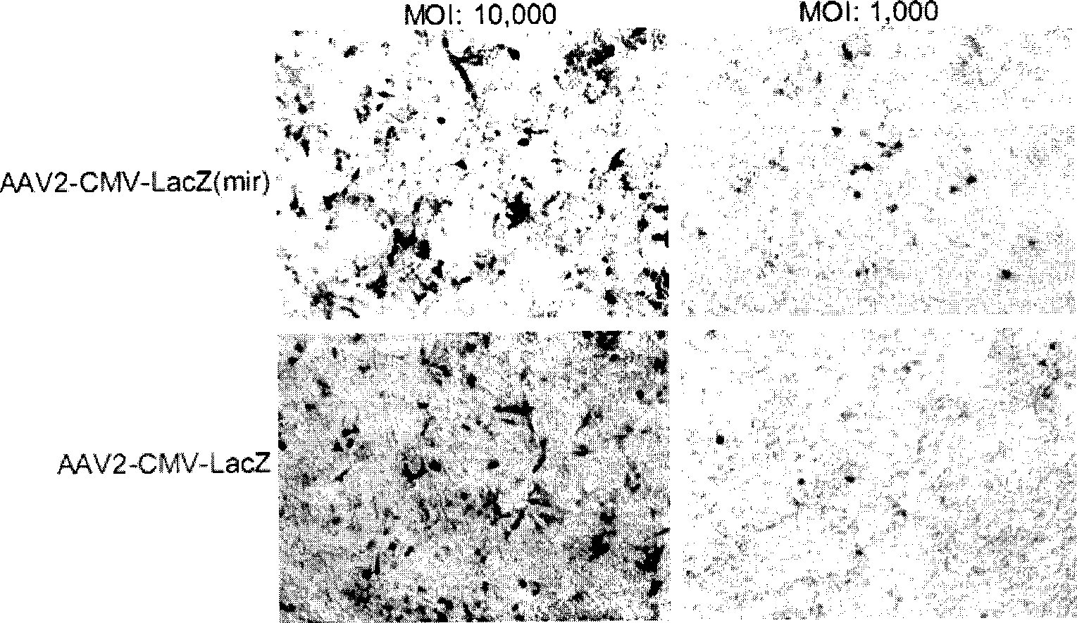 New type cell special gene HAAVmir containing microRNA combined sequence for gene treating