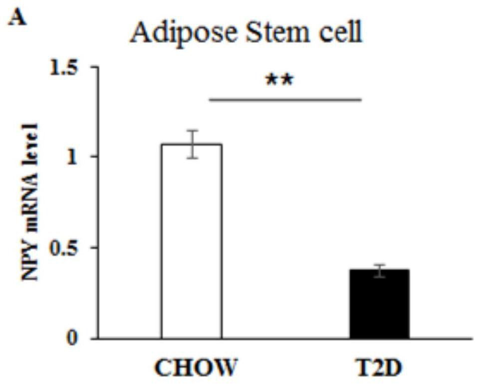 Repairing agent for promoting wound healing of type 2 diabetes