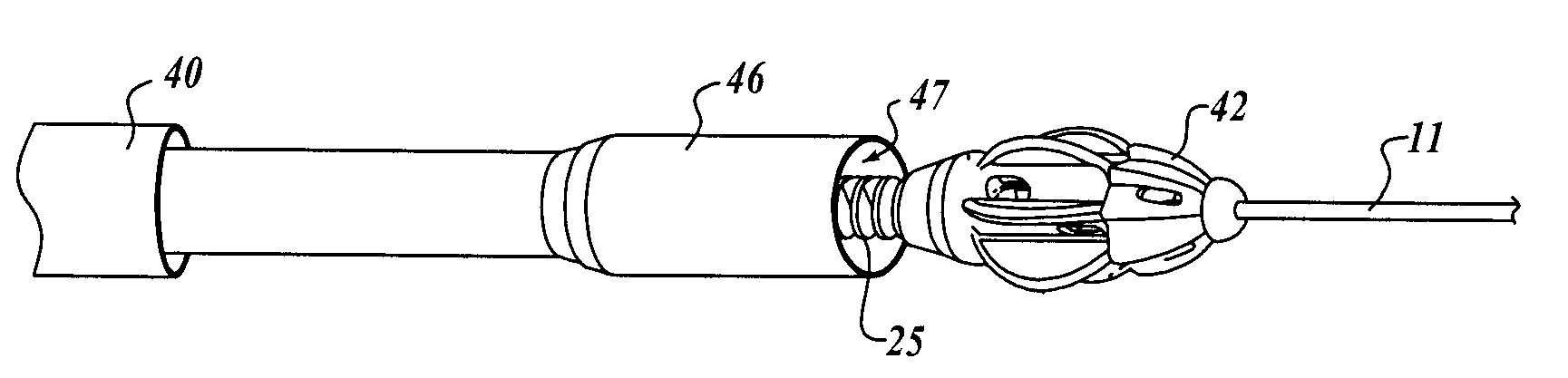 Intralumenal material removal using a cutting device for differential cutting