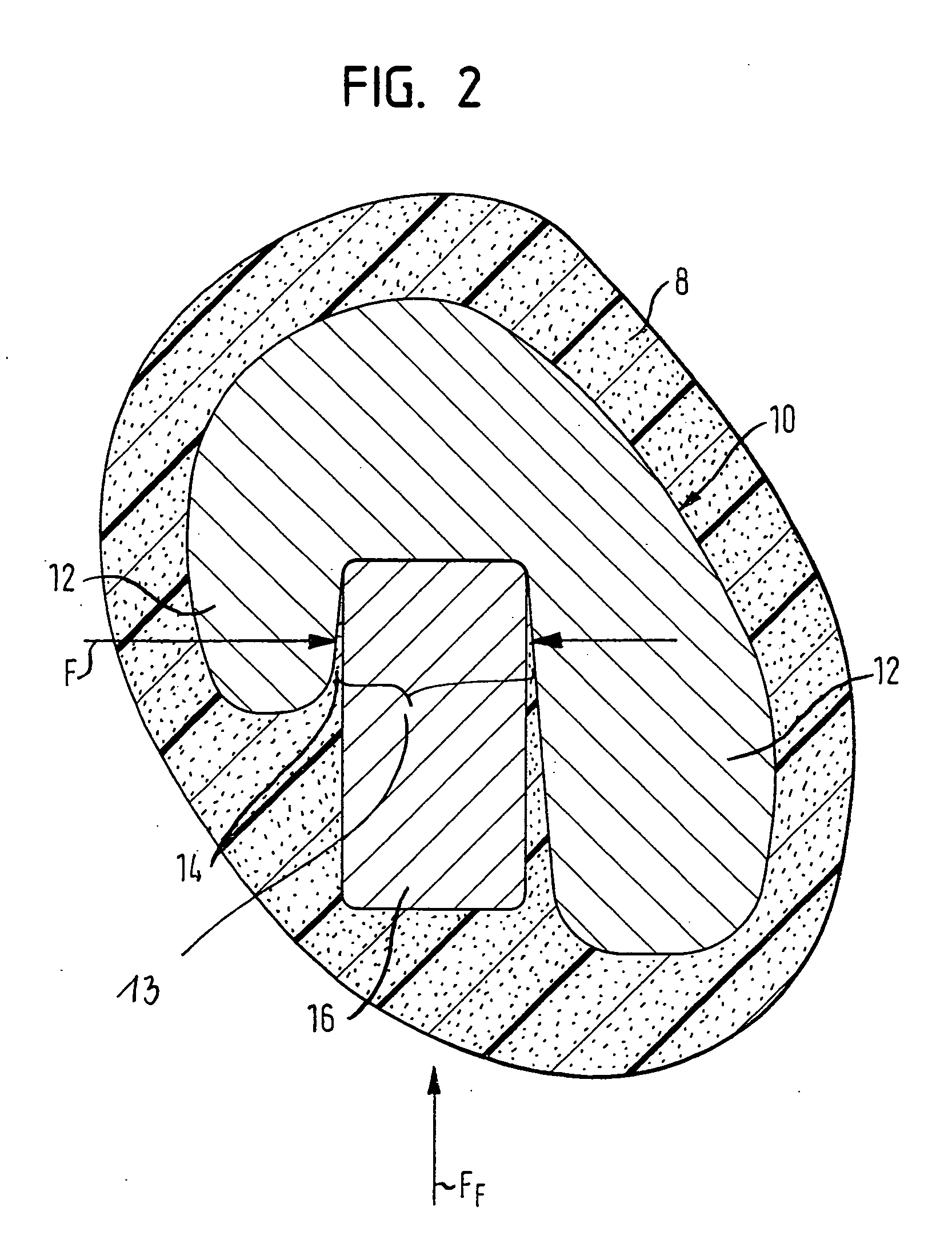 Vehicle steering wheel