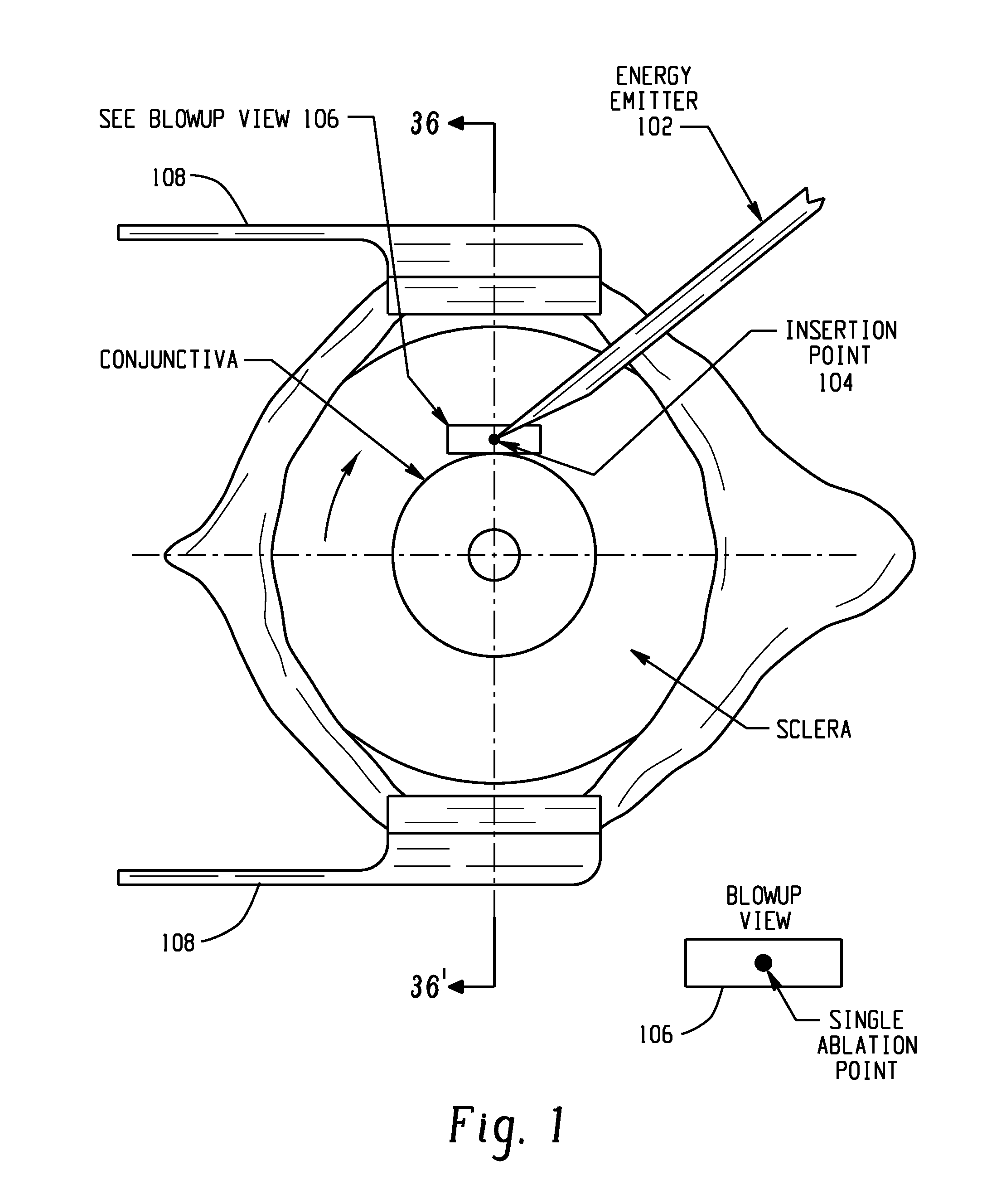 Methods for Treating Eye Conditions