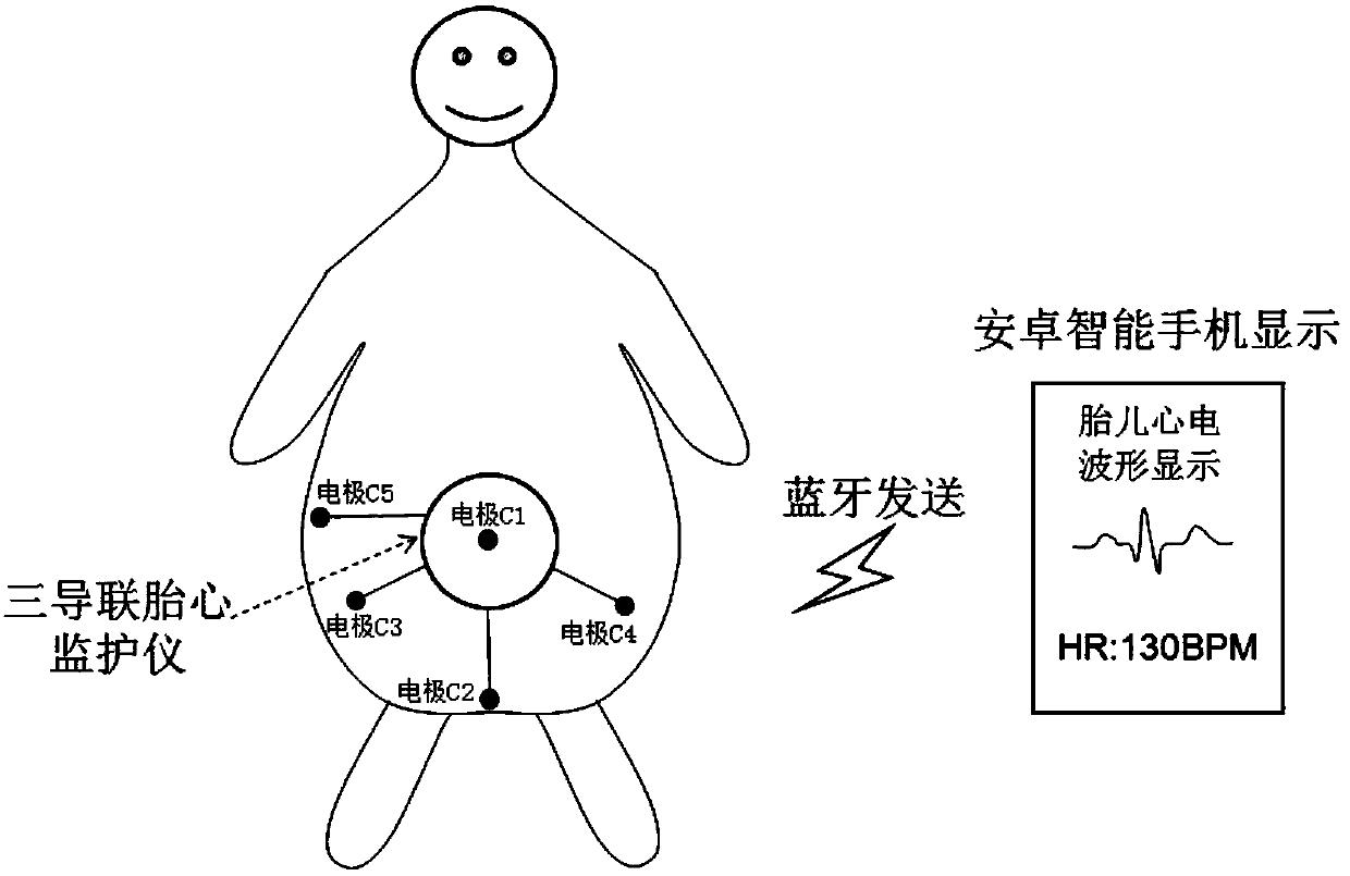 Fetal electrocardiogram monitoring system based on Android smartphone