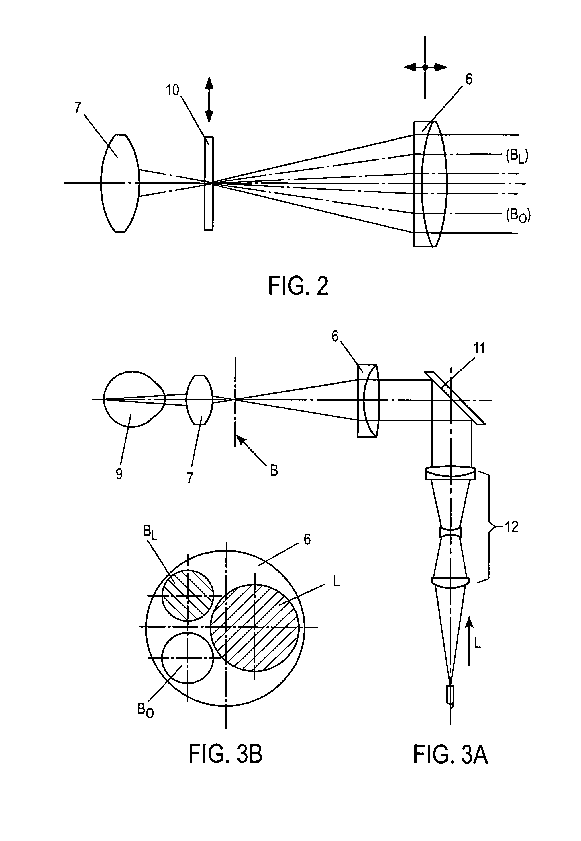 Ophthalmoscope