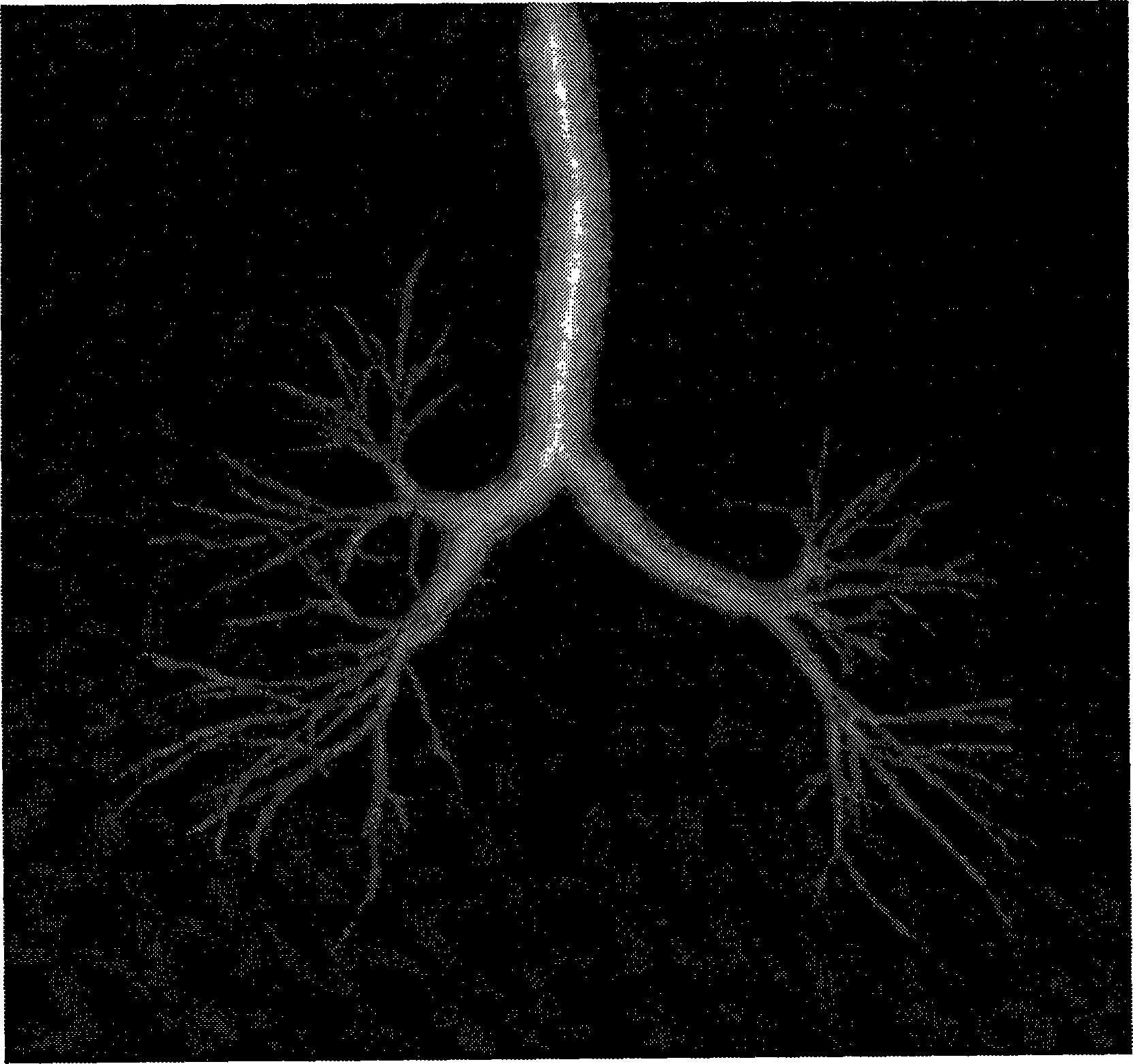 Planar angular visualization of the bronchial tree