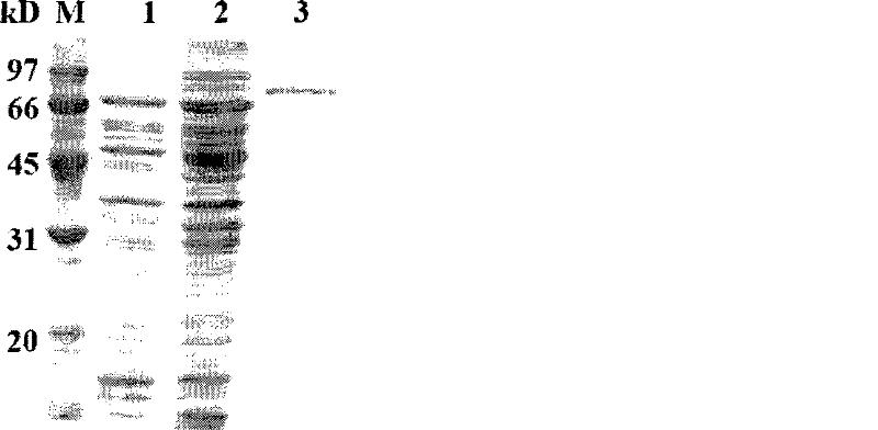 Novel antiprotease acid alpha-galactosidase AGA36 and gene and application thereof