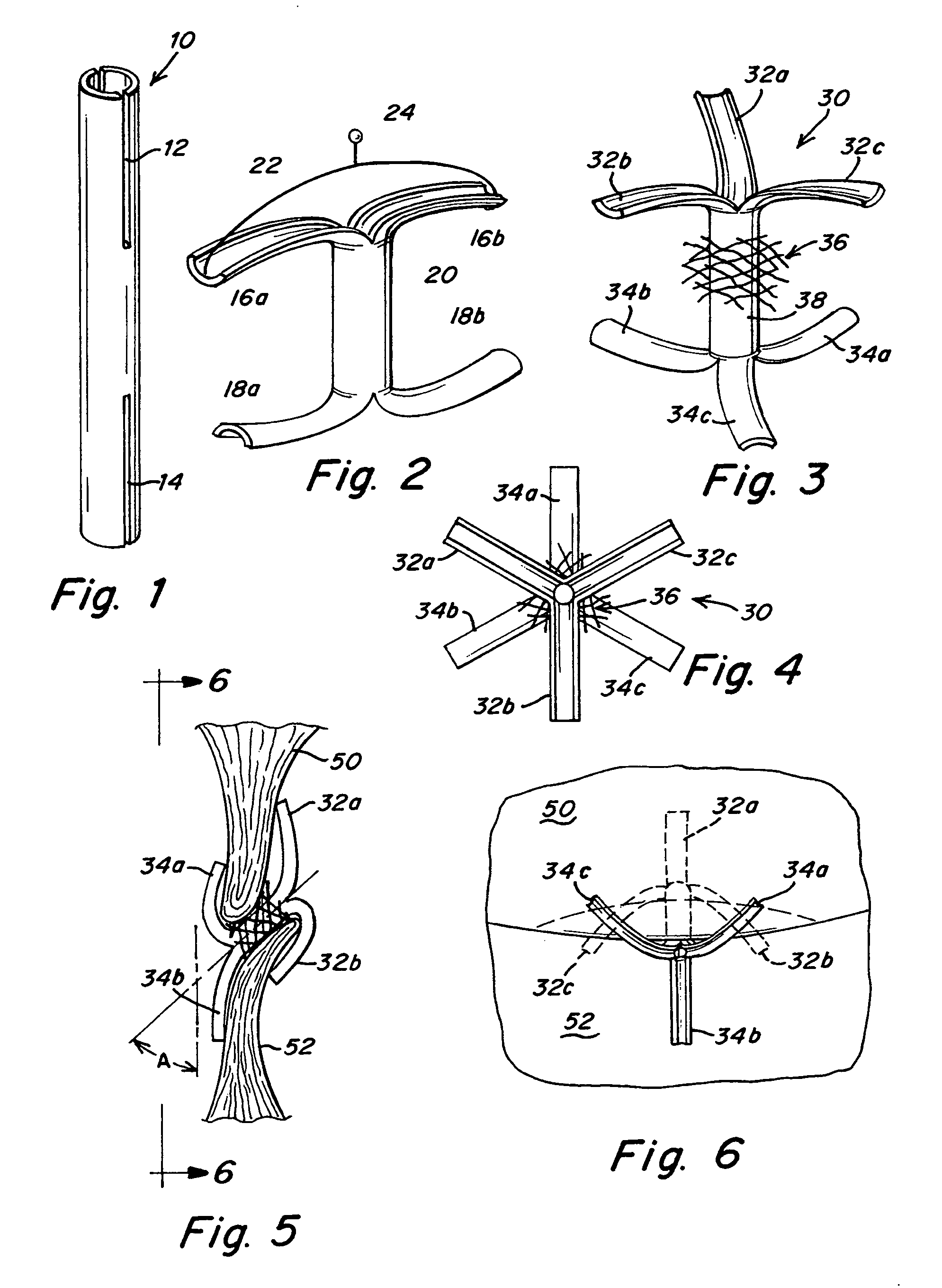 Split ends closure device