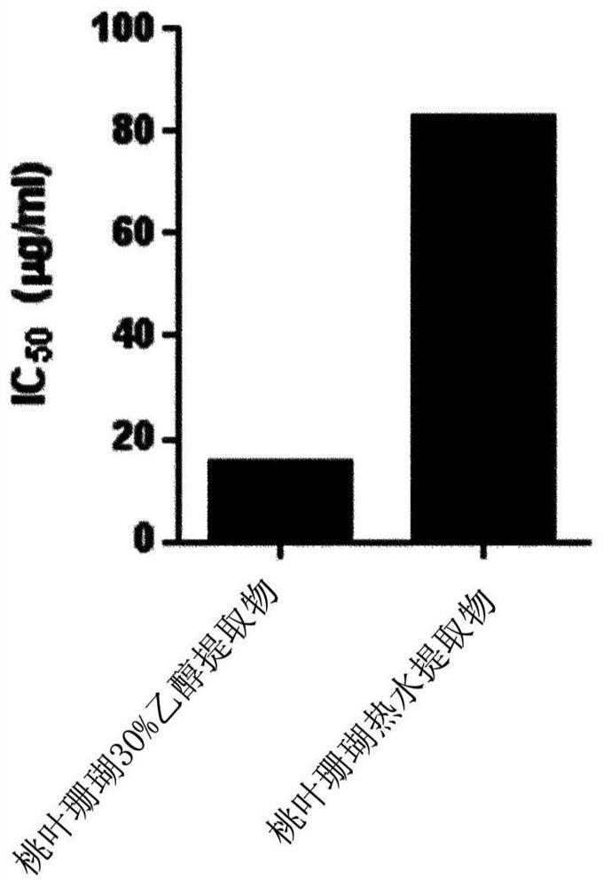 Pharmaceutical composition containing aucuba japonica extract for preventing or treating macular degeneration