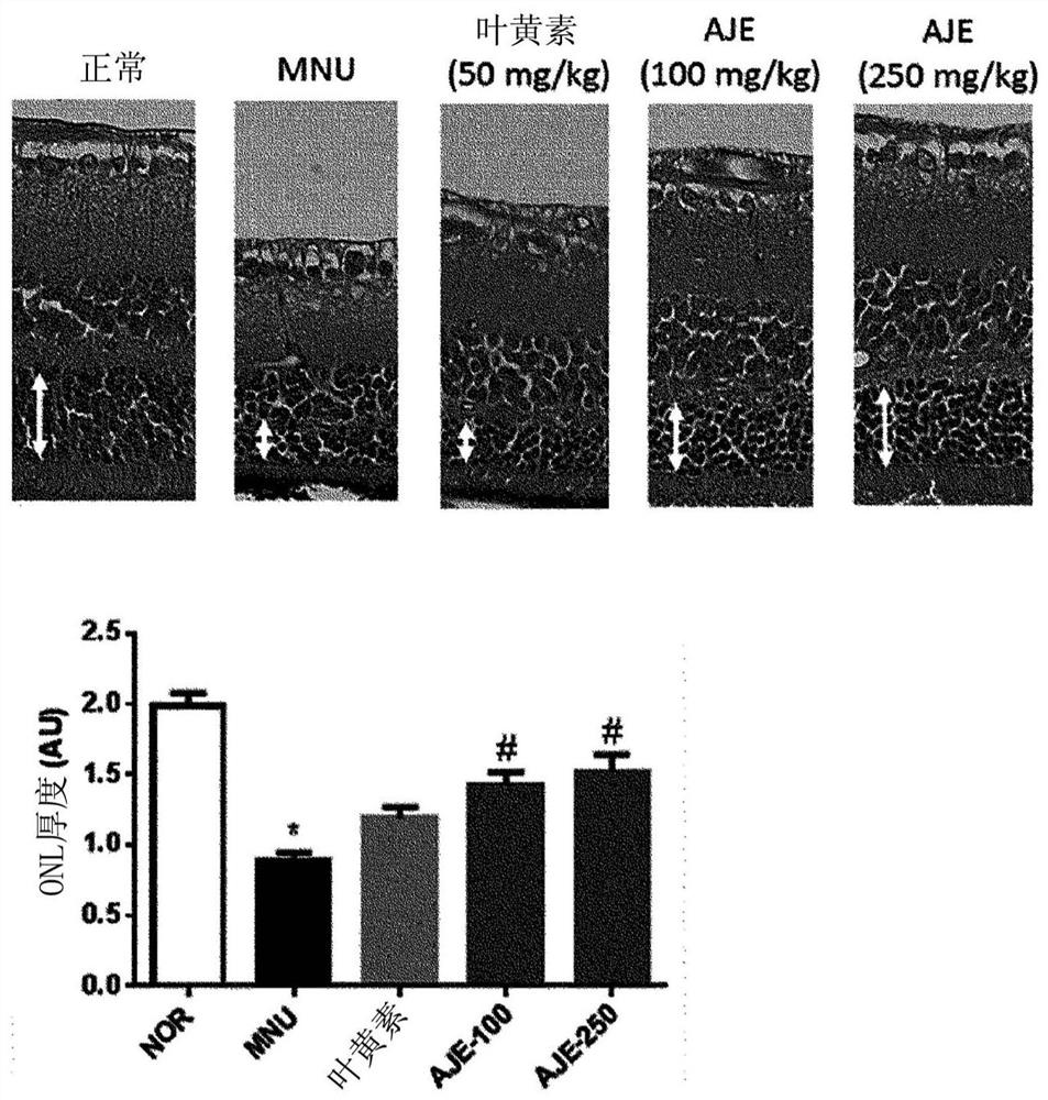 Pharmaceutical composition containing aucuba japonica extract for preventing or treating macular degeneration