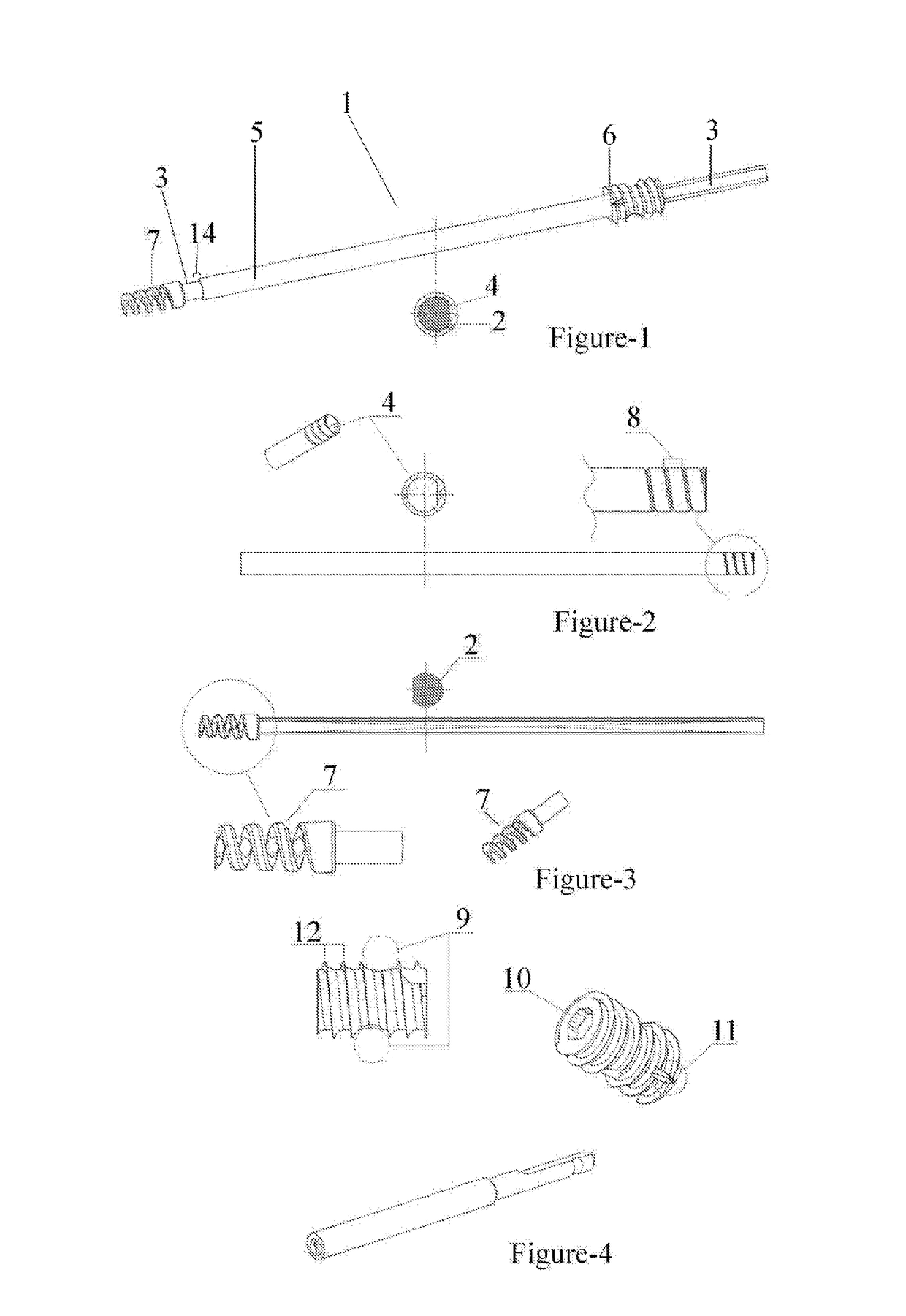 Telescopic nail