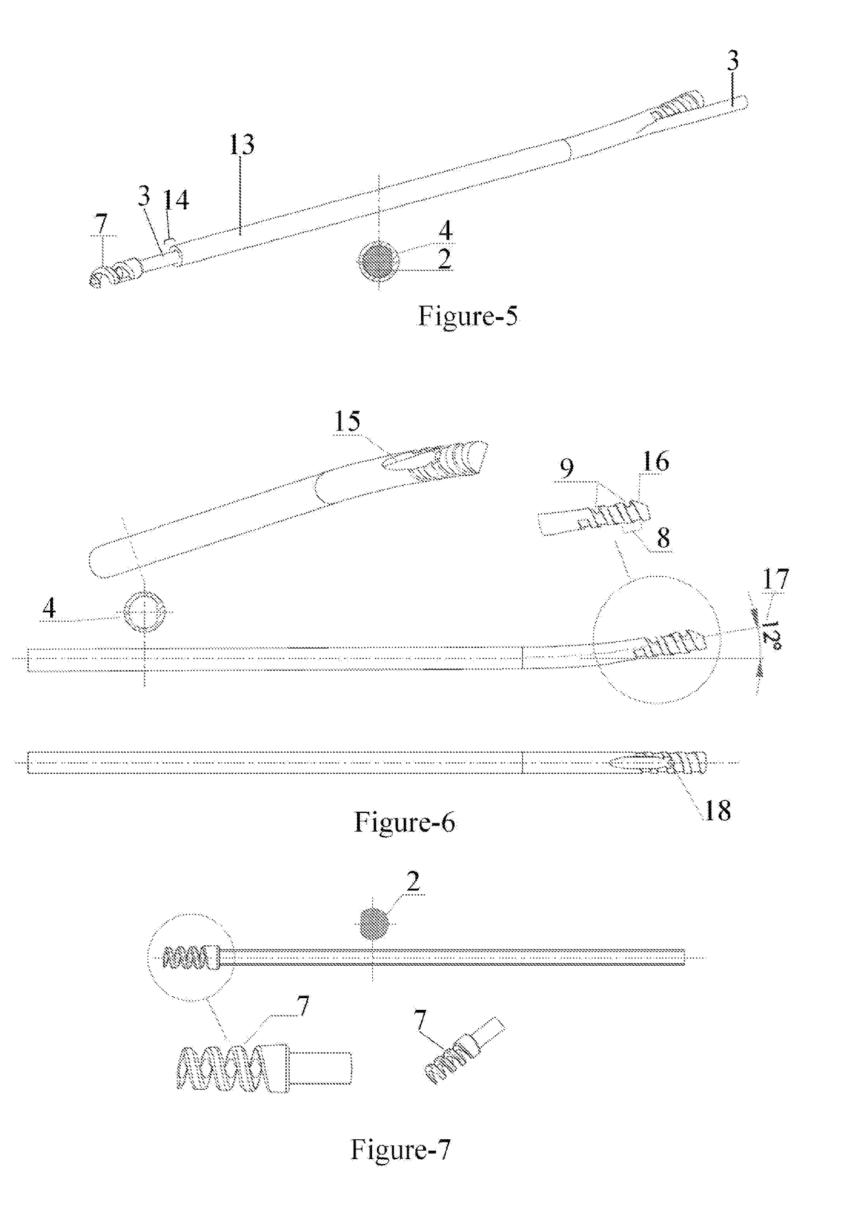 Telescopic nail