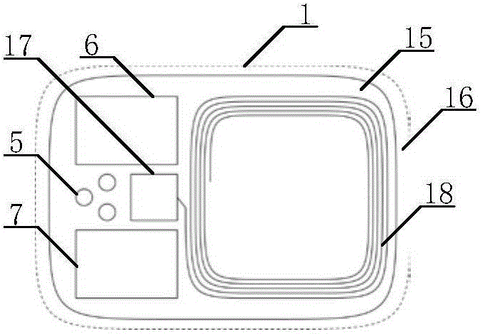 Real-time health monitoring system on basis of implantable and wearable bio-sensing technologies