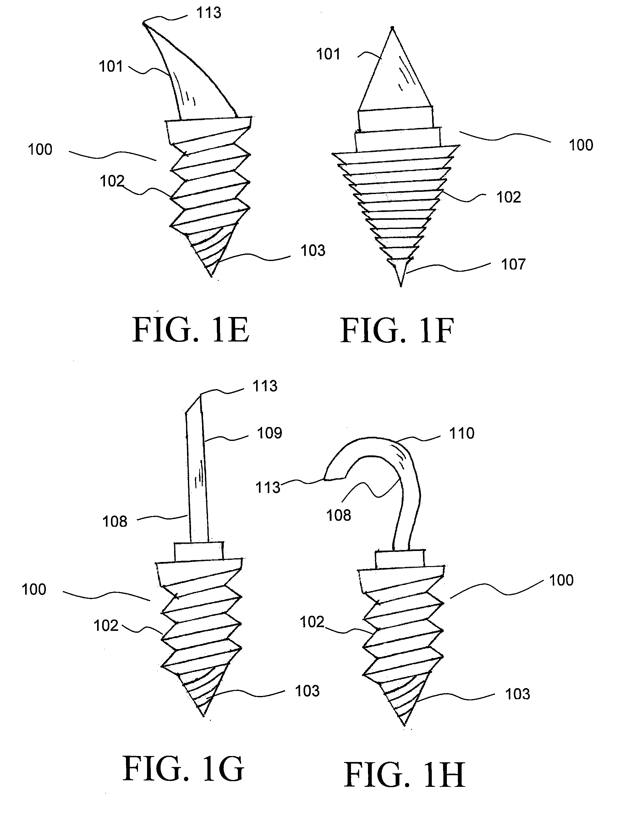 Apparatus for discrete tissue anchoring for soft tissue repair and method of use