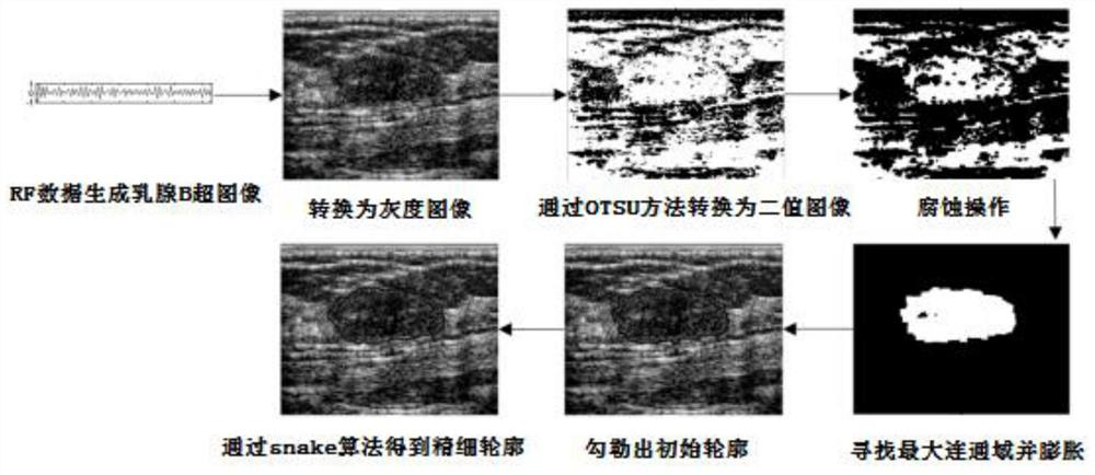 Portable ultrasonic breast tumor cloud classification system and method