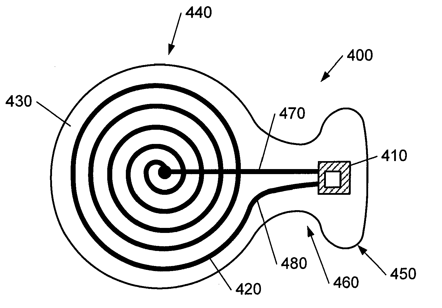 Device and method for glaucoma management and treatment