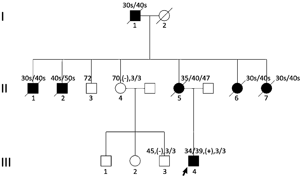 Novel mutation of Alzheimer disease, stable transfer cell model and medical application thereof