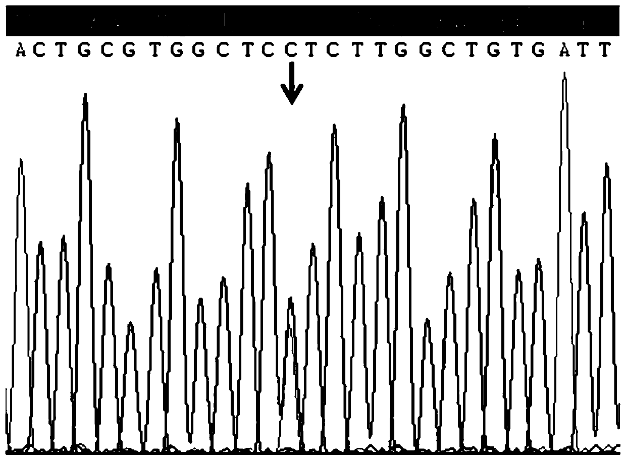 Novel mutation of Alzheimer disease, stable transfer cell model and medical application thereof