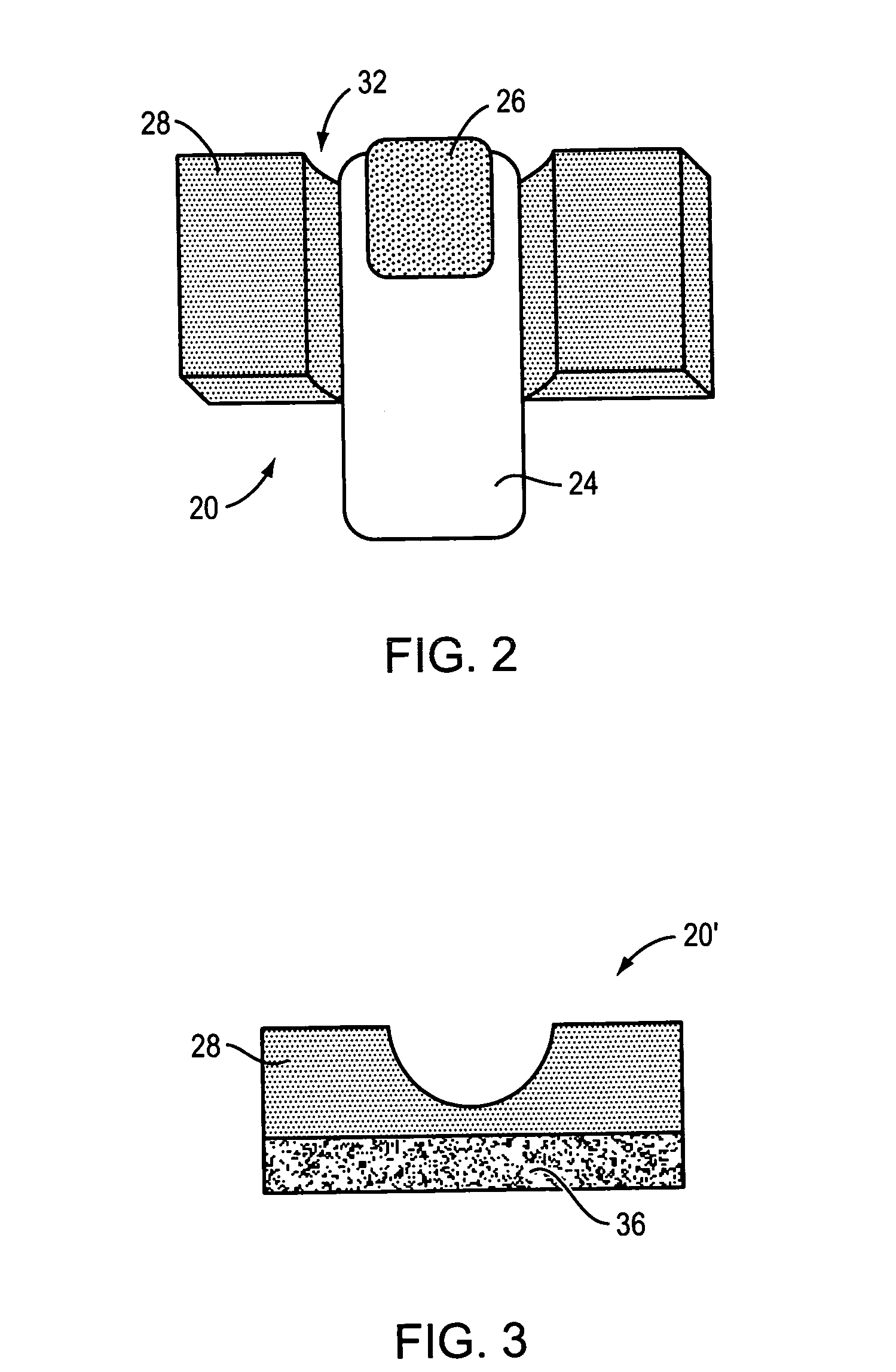 Method and apparatus for treating a diseased nail