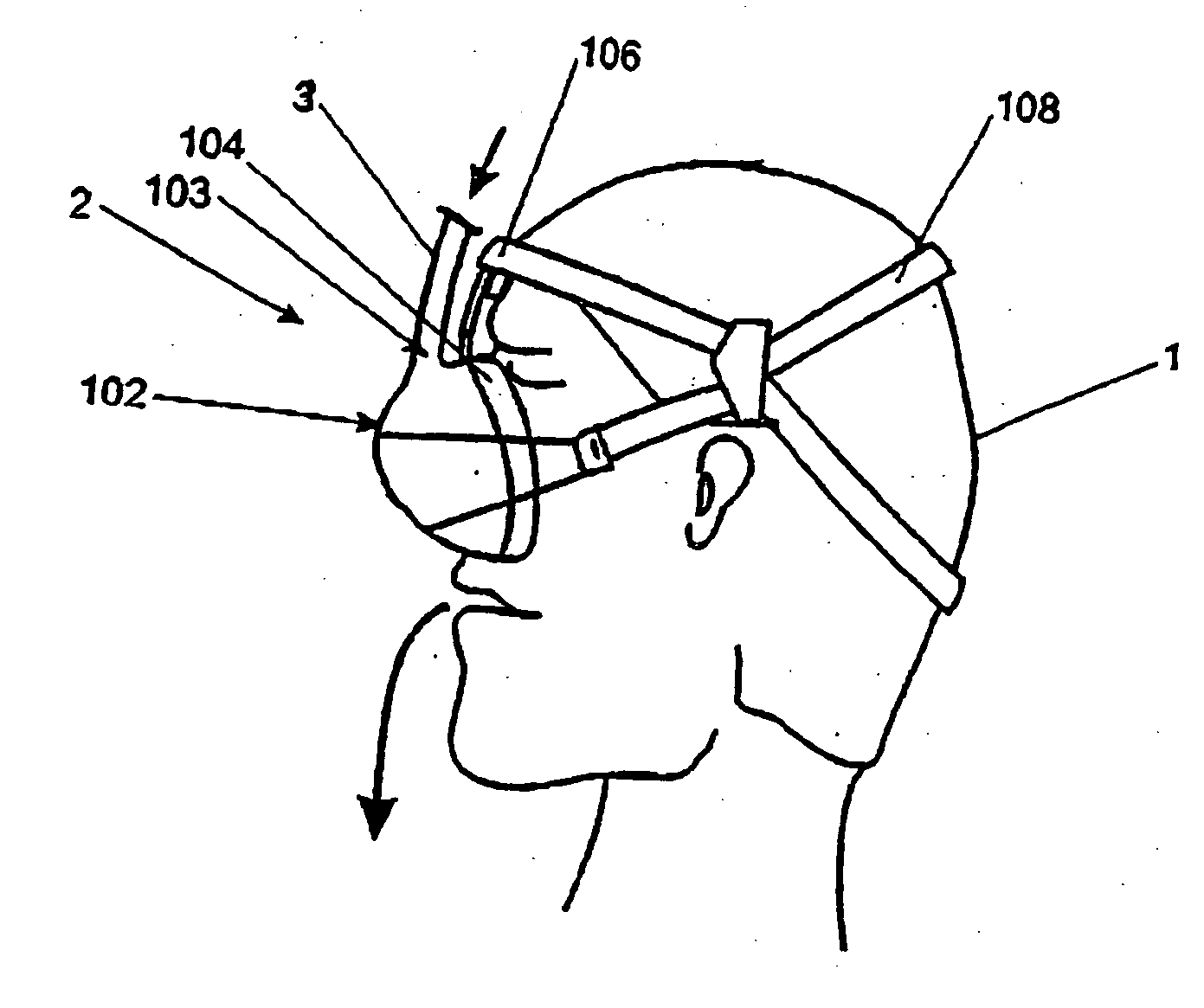 Patient interfaces